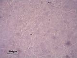 4 - Cellule stellate e cellule secretrici della zona midollare